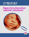 Doporuen ultrazvukov vyeten v thotenstv - Marek Lubuk; Ladislav Krofka; Lubomr Halk