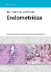 Endometriza - Lenz Ji; Chvtal Radek; Ludk Fiala