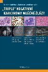 Triple negativn karcinomy mln lzy - Markta Kolekov; Katherine Vomkov