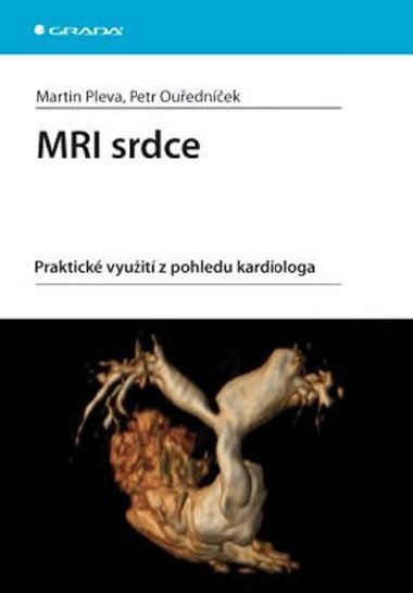 MRI srdce - praktick vyuit z pohledu kardiologa - Martin Pleva; Petr Ouednek