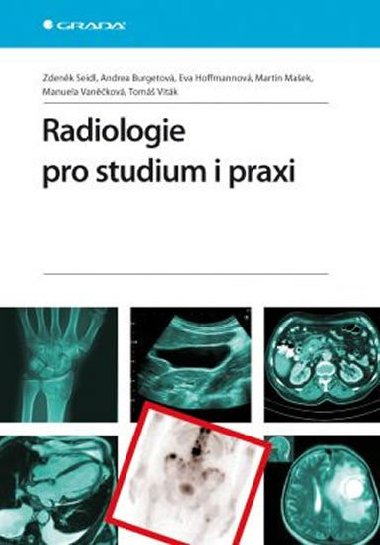 Radiologie pro studium i praxi - Zdenk Seidl; Andrea Burgetov; Eva Hoffmannov