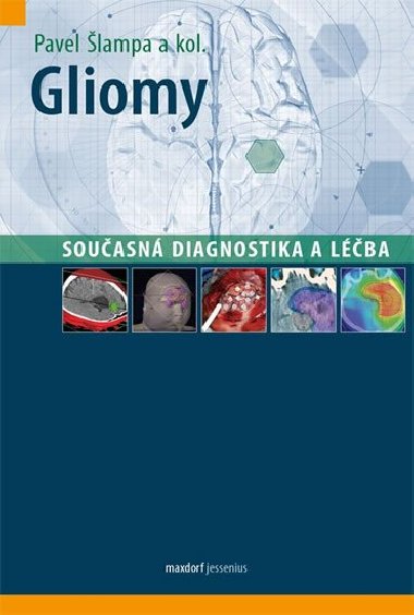 Gliomy - Současná diagnostika a léčba - Pavel Šlampa
