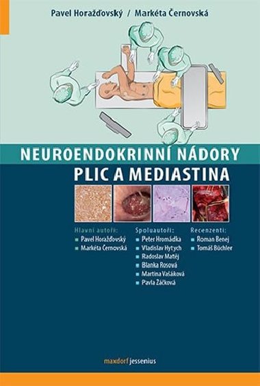 Neuroendokrinní nádory plic a mediastina - Pavel Horažďovský; Markéta Černovská