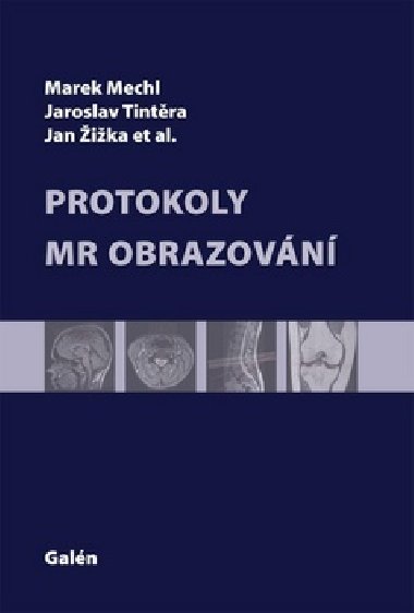 Protokoly MR Zobrazovn - Marek Mechl; Jaroslav Tintra; Jan ika