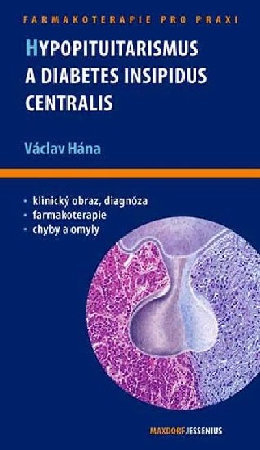 Hypopituitarismus a diabetes insipidus centralis - Hána Václav