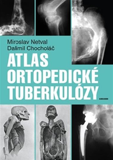 Atlas ortopedické tuberkulózy - Miroslav Netval