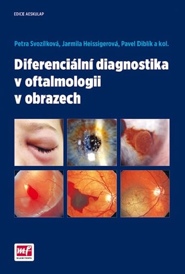 Diferenciln diagnostika v oftalmologii v obrazech - Petra Svozlkov; Jarmila Heissigerov; Pavel Diblk