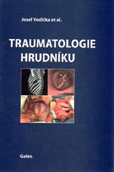 Traumatologie hrudnku - Josef Vodika