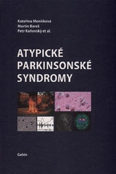 Atypick parkinsonsk syndromy - Kateina Menkov; Martin Bare; Petr Kaovsk