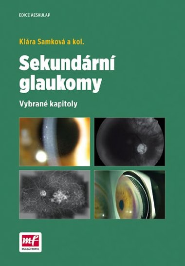 Sekundrn glaukomy - Vybran kapitoly - Klra Samkov