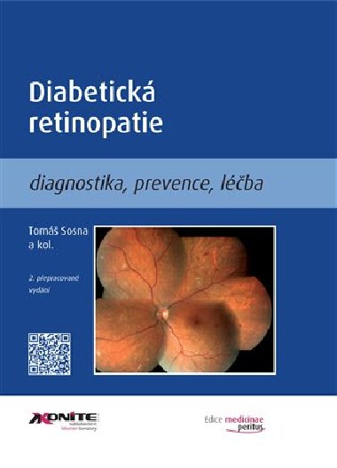 Diabetická retinopatie - Tomáš Sosna,kol.
