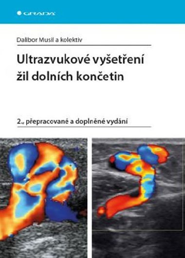 Ultrazvukov vyeten il dolnch konetin - Dalibor Musil
