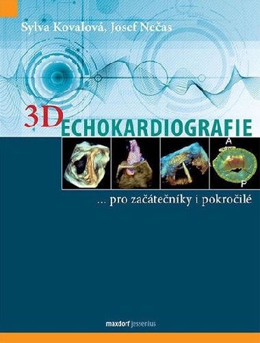 3D Echokardiografie - Sylva Kovalov; Josef Neas