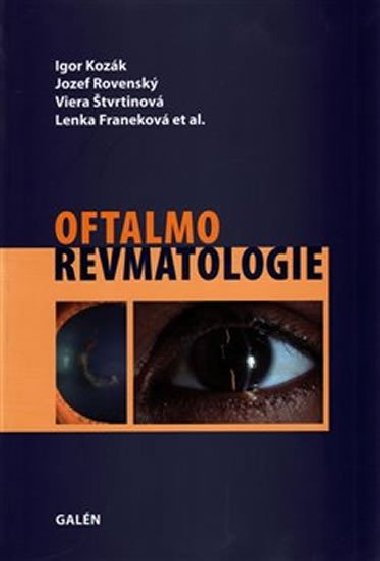 Oftalmorevmatologie - Viera tvrtinov; Jozef Rovensk; Igor Kozk