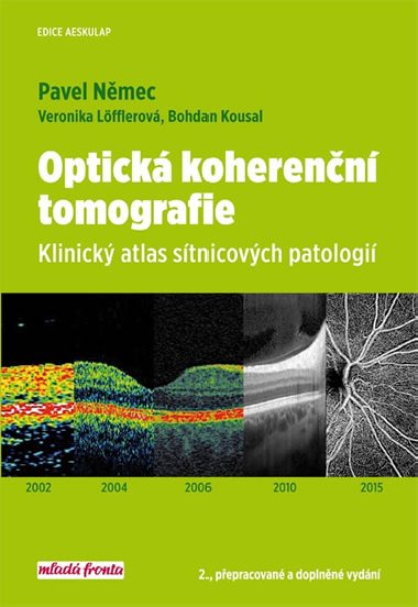 Optick koherenn tomografie - Klinick atlas stnicovch patologi - Pavel Nmec; Bohdan Kousal; Veronika Lfflerov