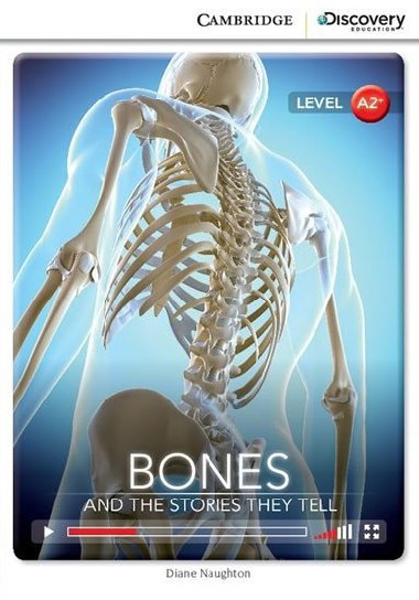 Bones: And the Stories They Tell Low Intermediate (Book with Online Access) - Naughton Diane