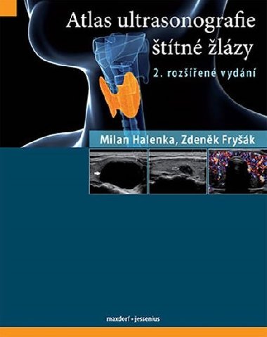 Atlas ultrasonografie ttn lzy - Zdenk Fryk; Milan Halenka
