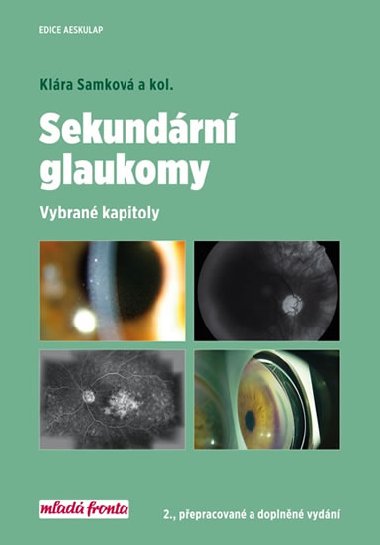 Sekundrn glaukomy - Vybran kapitoly - Klra Samkov