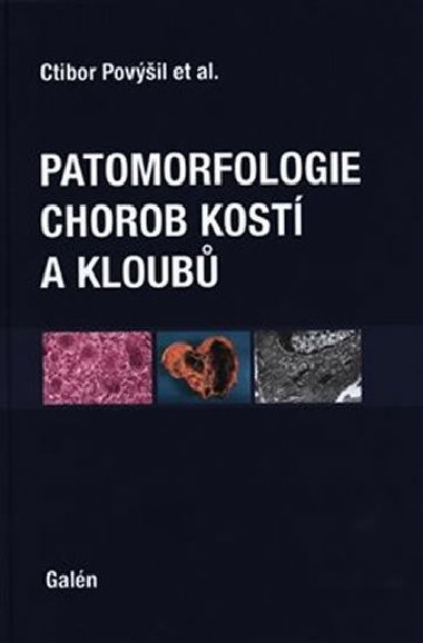 Patomorfologie chorob kost a kloub - Ctibor Povil