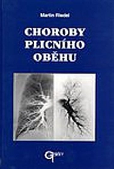 Choroby plicnho obhu - Riedel Martin