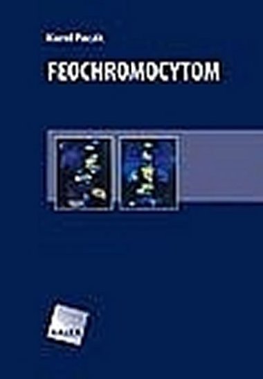 Feochromocytom - Pacák Karel