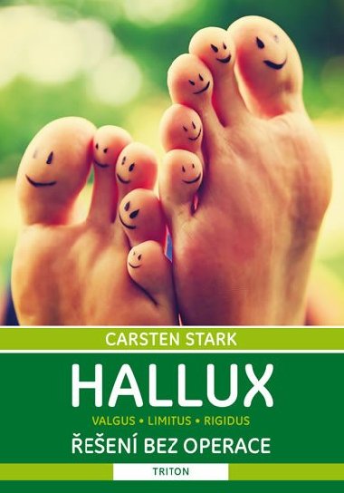 Hallux - een bez operace - Carsten Stark