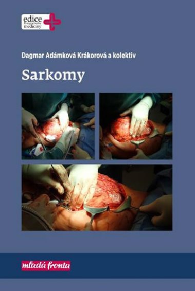 Sarkomy - Dagmar Admkov Krkorov
