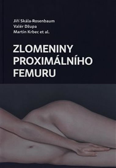 Zlomeniny proximálního femuru - Jiří Skála-Rosenbaum; Valér Džupa; Martin Krbec