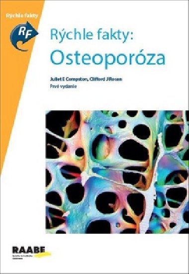 Rchle fakty: Osteoporza - Juliet Compston; Clifford Rosen