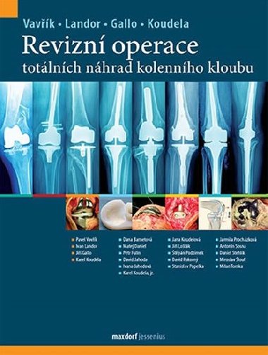 Revizn operace totlnch nhrad kolennho kloubu - Pavel Vavk; Ji Gallo; Ivan Landor
