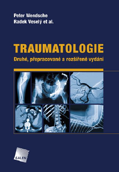 Traumatologie - Peter Wendsche; Radek Vesel