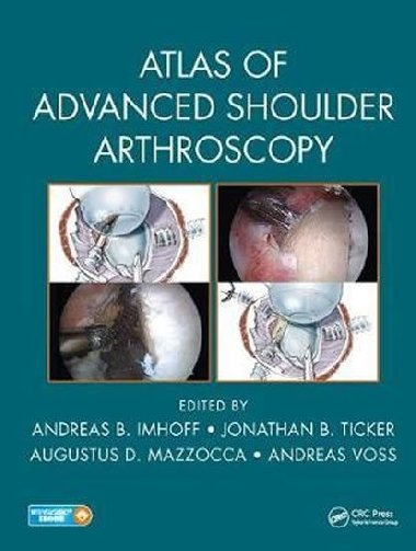 Atlas of Advanced Shoulder Art - neuveden