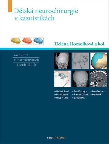 Dtsk neurochirurgie v kazuistikch - Helena Homolkov