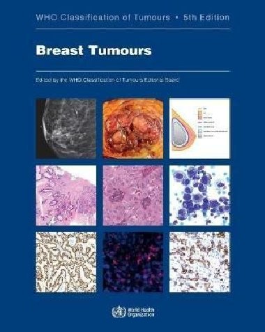 WHO classification of tumours of the breast - World Health Organization