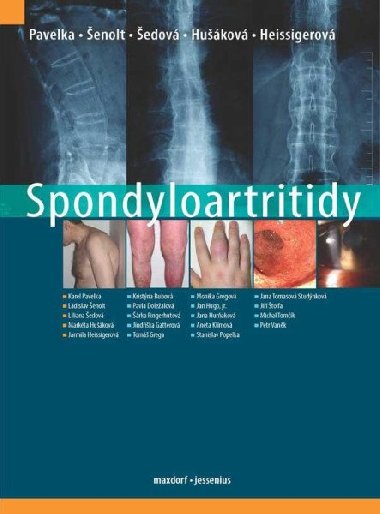 Spondyloartritidy - Karel Pavelka; Ladislav enolt; Liliana edov