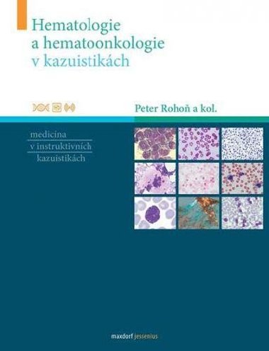 Hematologie a hematoonkologie v kazuistikách - Peter Rohoň