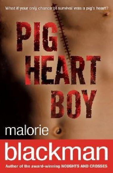 Pig-Heart Boy - Blackman Malorie
