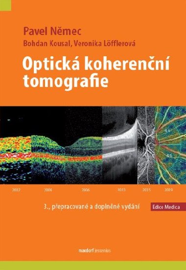 Optická koherenční tomografie - Veronika Löfflerová; Bohdan Kousal; Pavel Němec