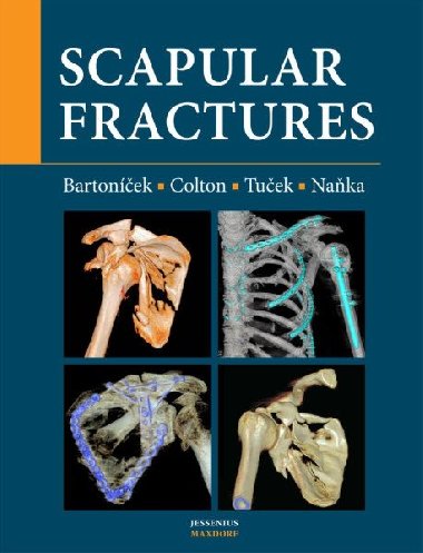 Scapular fractures - Jan Bartoníček; Christopher Colton; Michal Tuček