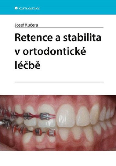 Retence a stabilita v ortodontické léčbě - Josef Kučera