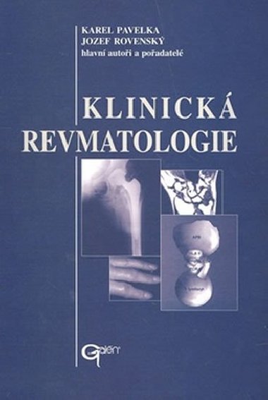 Klinick revmatologie - Karel Pavelka, Josef Rovensk