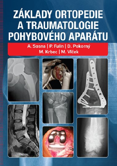 Zklady ortopedie a traumatologie pohybovho apartu - Sosna Antonn