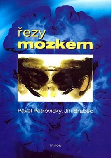 EZY MOZKEM - Pavel Petrovick