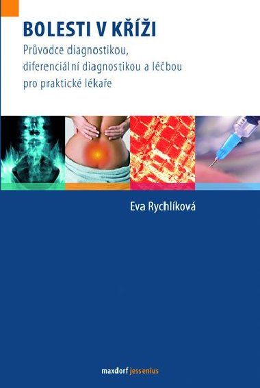 Bolesti v ki - Prvodce diagnostikou, diferenciln diagnostikou a lbou pro praktick lkae - Eva Rychlkov