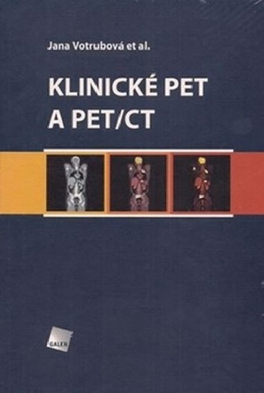 KLINICK PET A PET/CT - Jana Votrubov