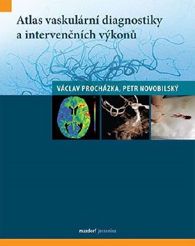 Atlas vaskulární diagnostiky a intervenčních výkonů - Václav Procházka; Petr Novobilský