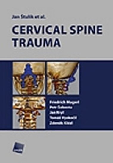 Cervical spine trauma - Štulík Jan