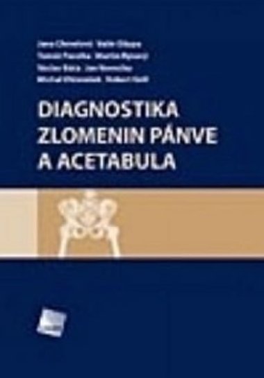 Diagnostika zlomenin pánve a acetabula - Vavrečka Jan