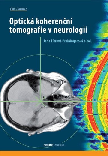 Optická koherenční tomografie v neurologii - Jana Lízrová Preiningerová