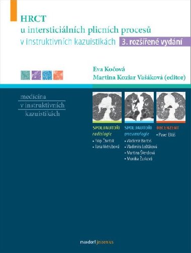 HRCT u intersticiálních plicních procesů v instruktivních kazuistikách - Eva Kočová; Martina Vašáková